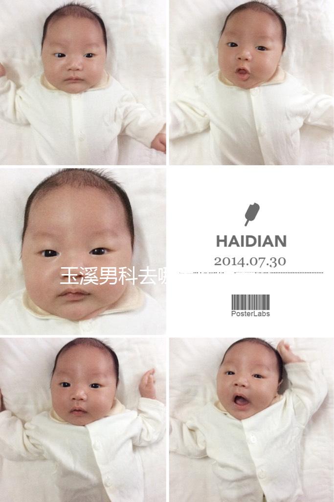 玉溪男科去哪家醫(yī)院看好,怎么選攻略,這個(gè)排行榜不要錯(cuò)過(guò)