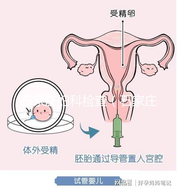 石家莊婦科檢查（石家莊最好婦科的醫院）