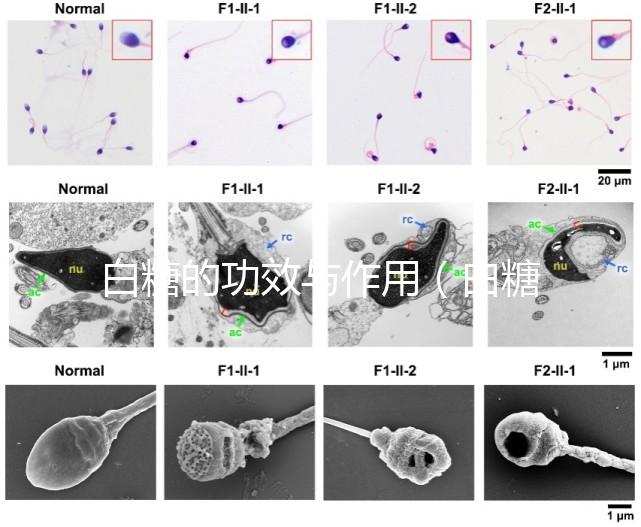 白糖的功效與作用(白糖的功效與作用及營養價值)