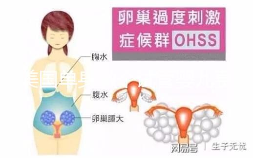 美國單身做個試管嬰兒費用大概要多少?