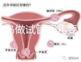 去青島做試管嬰兒要多少錢?