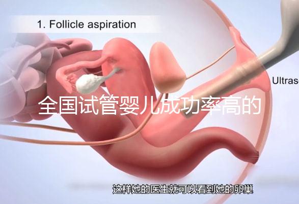 全國試管嬰兒成功率高的醫(yī)院有哪些？（全國試管嬰兒成功率高的醫(yī)院目錄一覽）