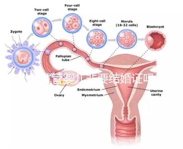 做試管嬰兒非要結(jié)婚證嗎？做試管嬰兒一定需要結(jié)婚證嗎？