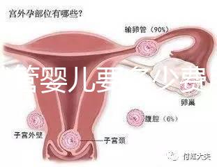 做試管嬰兒要多少費用（做試管嬰兒要多少費用？）