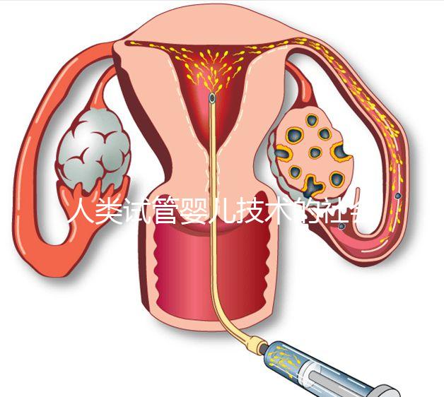 人類試管嬰兒技術(shù)的社會價值