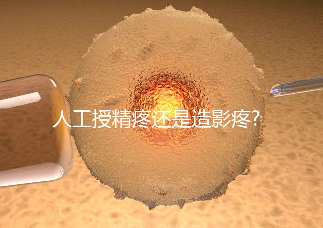 人工授精疼還是造影疼?被瞎對比，二者疼痛不是一個等級