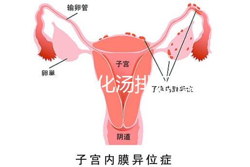 產后喝生化湯排惡露會使寶寶拉肚子？醫生：時間沒用對