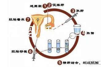 代試管嬰兒和第二代試管嬰兒的區(qū)別，基因篩查技術(shù)！
