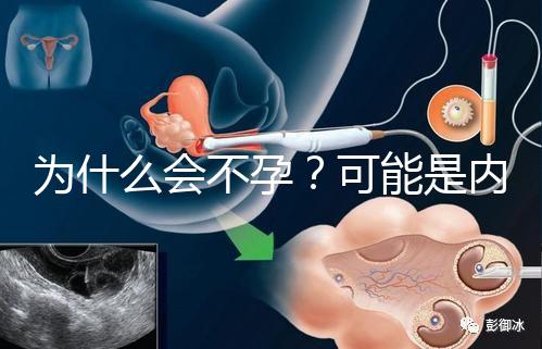 為什么會(huì)不孕?可能是內(nèi)分泌失調(diào)在搗亂!