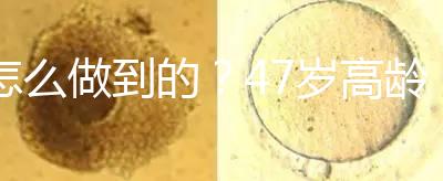 怎么做到的？47歲高齡試管嬰兒唯一男胚一次移植成功！