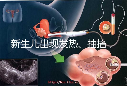 新生兒出現發熱、抽搐，很可能是胎毒的表現
