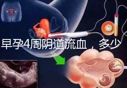 早孕4周陰道流血,多少天檢查血hcg或B超更穩(wěn)妥?