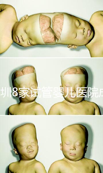 深圳8家試管嬰兒醫(yī)院成功率排名，供卵、供精首選各不同