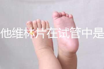 屈他維林片在試管中是否有副作用,導(dǎo)致胎停不是空穴來風(fēng)