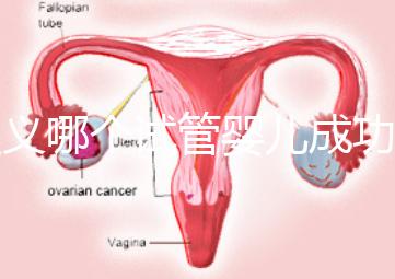 遵義哪個(gè)試管嬰兒成功率高?貴州生殖中心醫(yī)院2024年排名參考