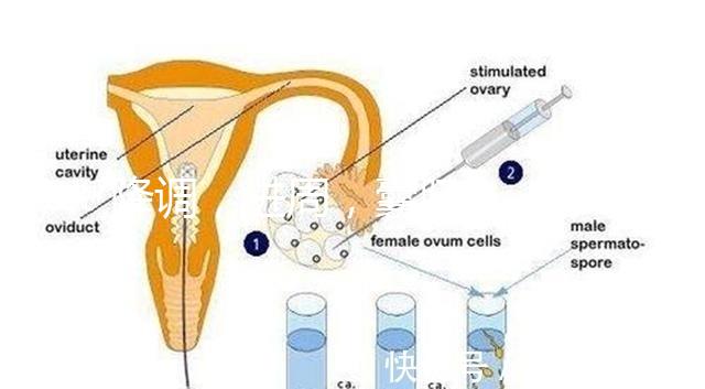 降調(diào),進周,囊胚……這些試管嬰兒助孕術(shù)語你都懂嗎?