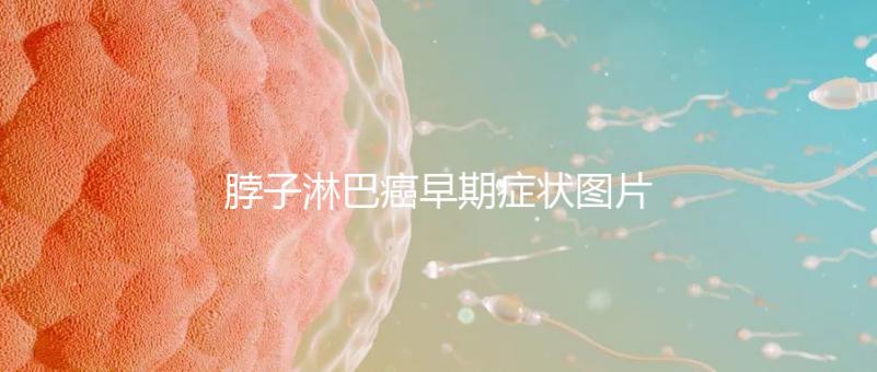 脖子淋巴癌早期癥狀圖片（脖子上有結節(jié)的圖片）