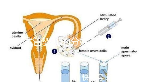 試管嬰兒的分娩方式有哪些？能否自然分娩取決于情況