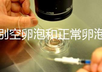 辨別空卵泡和正常卵泡是有技巧的，只需要了解這四個方面就可以輕松辨別，快速學習！