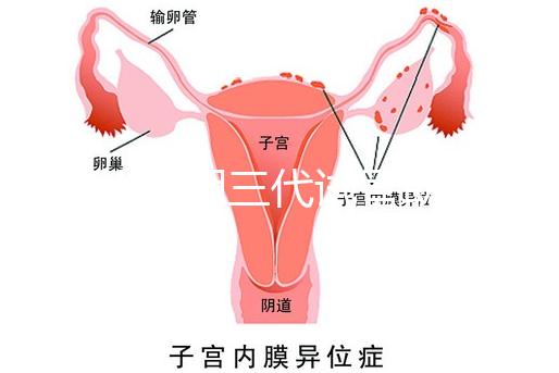 2025昆明三代試管助孕費(fèi)用一覽，8-15萬(wàn)元，價(jià)格透明公開(kāi)自主選擇